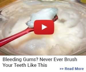 Bleeding Gums? Never Ever Brush Your Teeth Like This